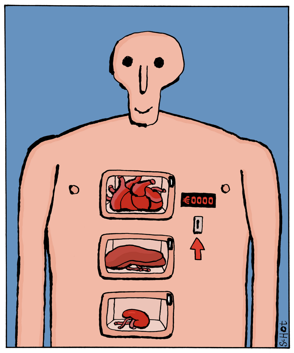 Donor