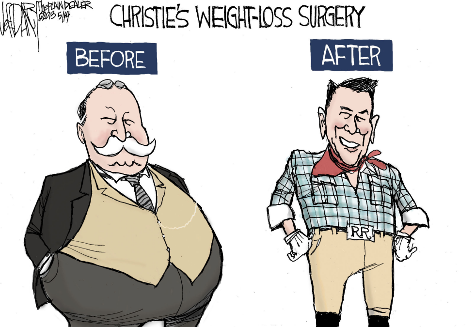 Christie weight-loss surgery