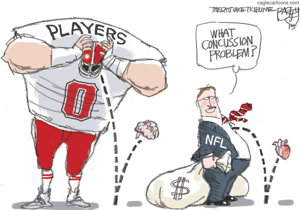 Concussion COLOR
