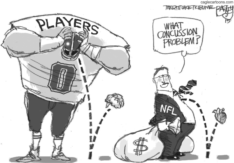 Concussion