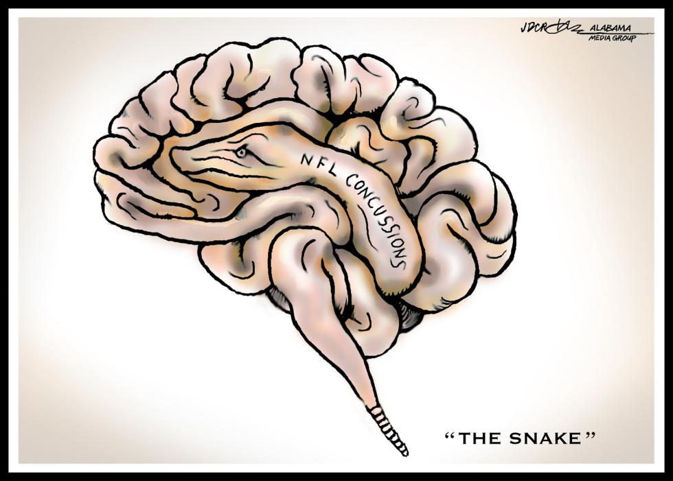 NFL Concussion "Snake"