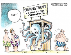 CUPPING THERAPY  by Dave Granlund