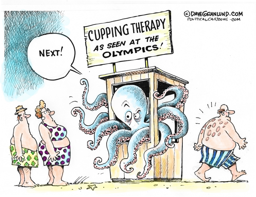  CUPPING THERAPY by Dave Granlund