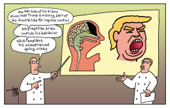 TRUMP'S BRAINS by Arend Van Dam