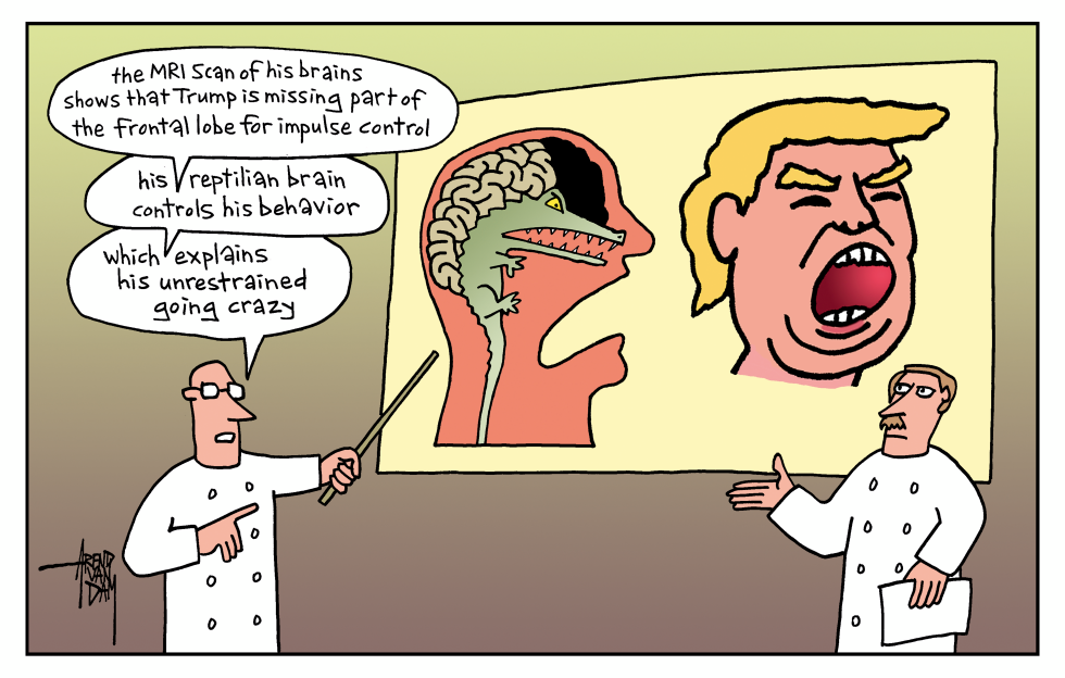 Trump's brains