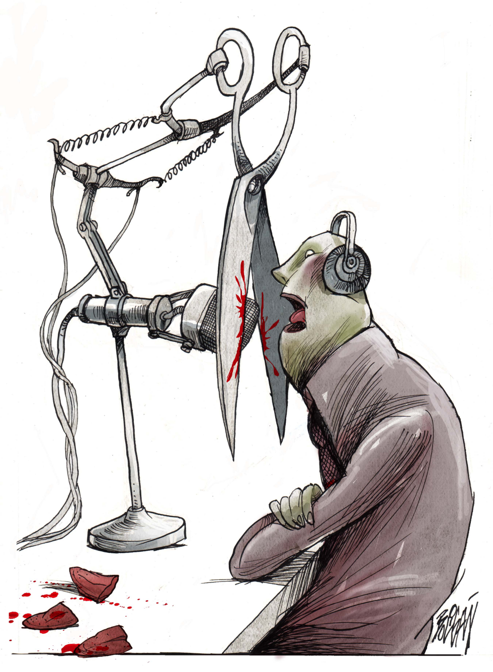 Mecanismo de censura radial /