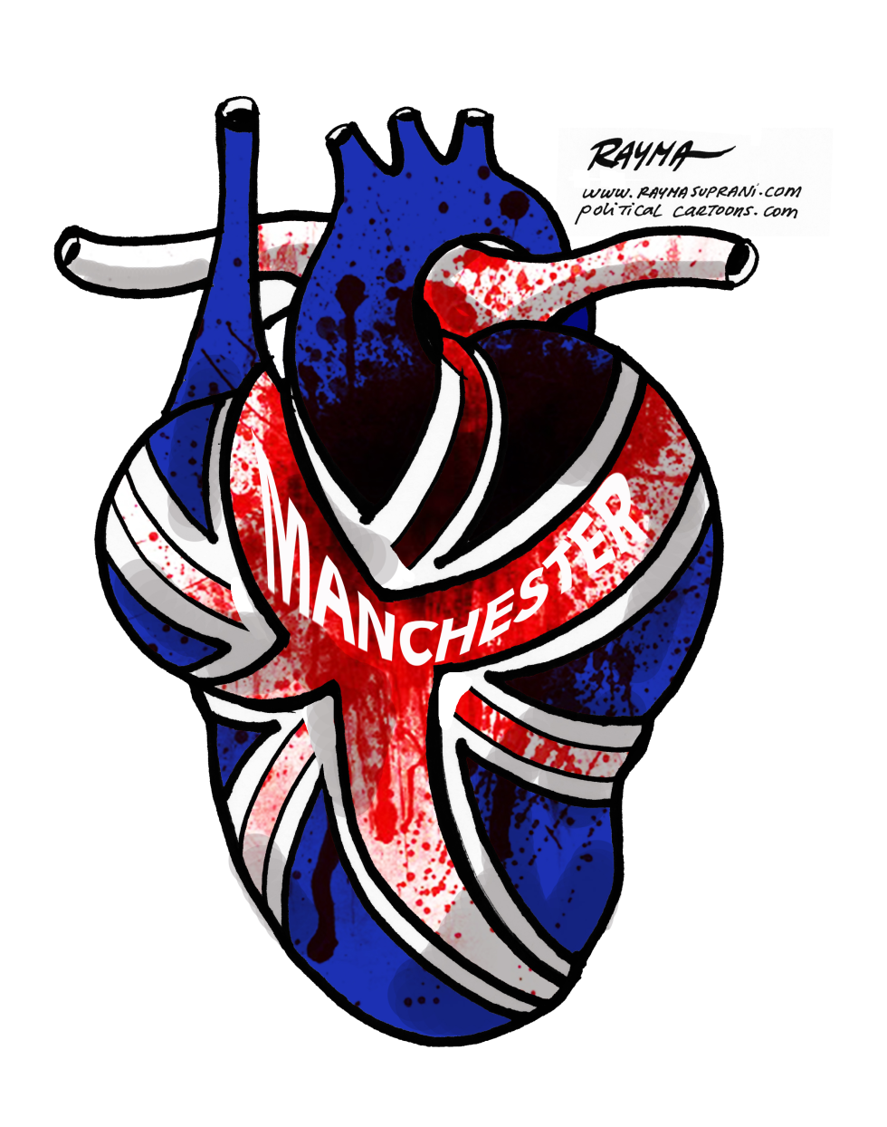 MANCHESTER ATTACK by Rayma Suprani