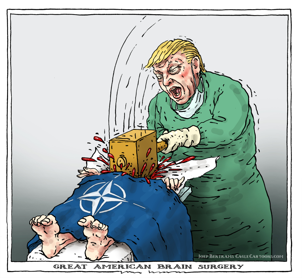 great american brain surgery