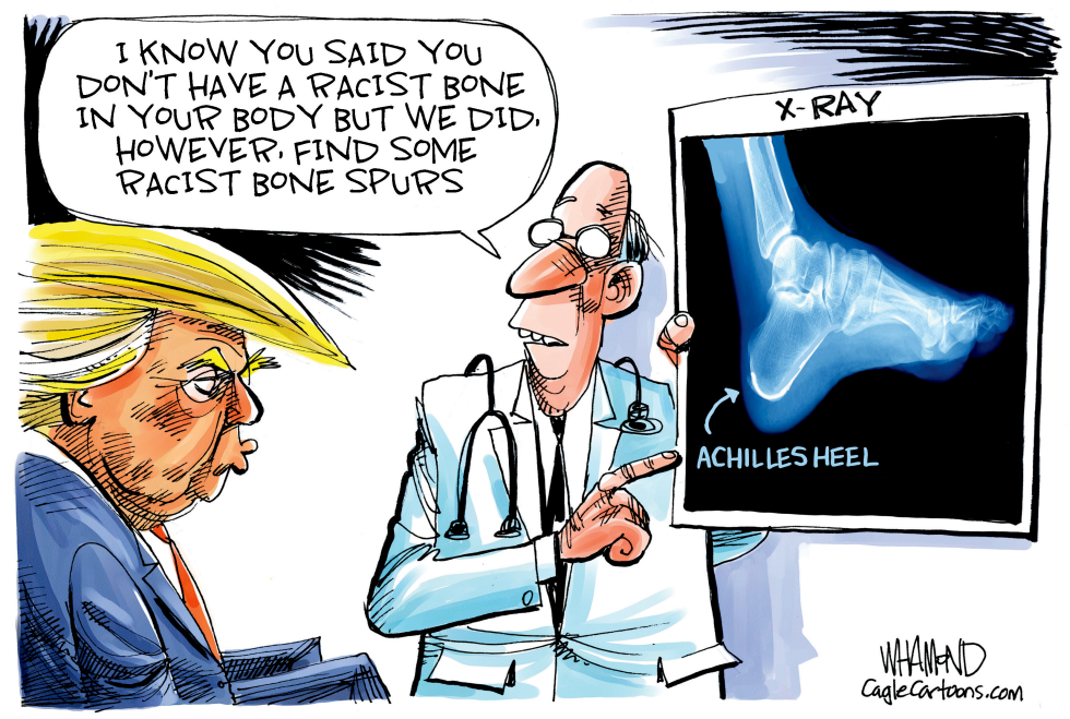 Trump's achilles heel