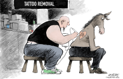 TATTOO REMOVAL  by Rivers