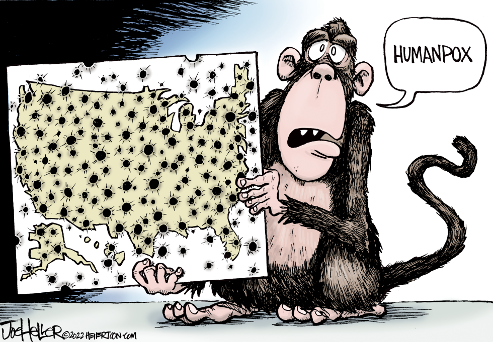 American Pox