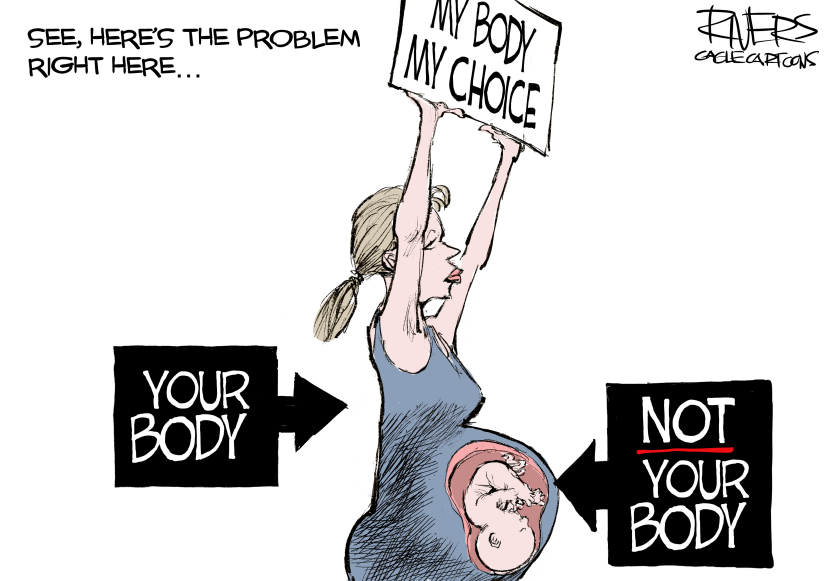 Ergo not your choice