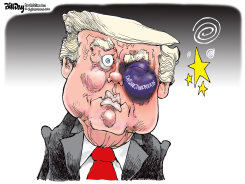 TRUMP'S BLACK EYE by Bill Day