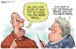 NEURALINK IMPLANT by Rick McKee