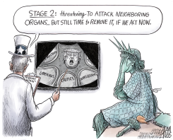 TRUMP STAGE 2 by Adam Zyglis