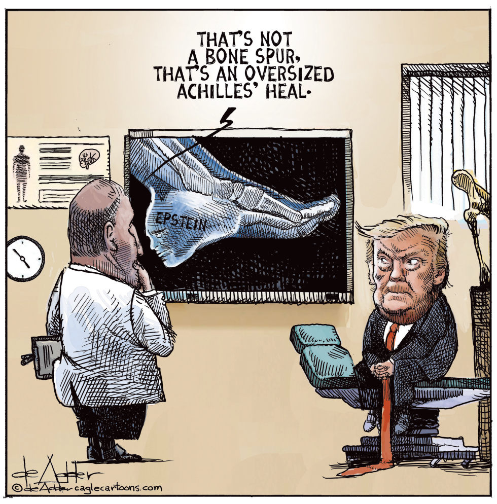Doctor says Trump's bone spur is his achilles heal
