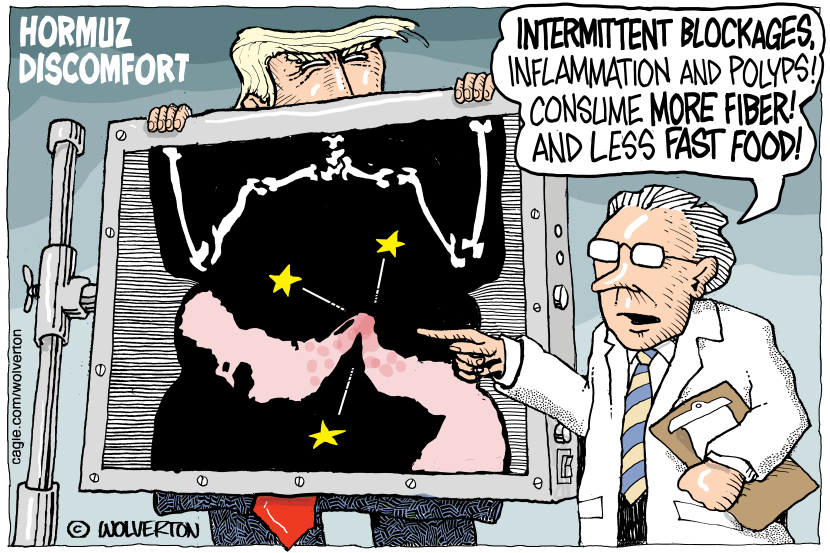 In this xray cartoon, a doctor points out intestine blockages shaped like the Hormuz strait, advising Trump on more fiber to ease inflammation.