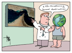 BOWEL OBSTRUCTION by Arend van Dam