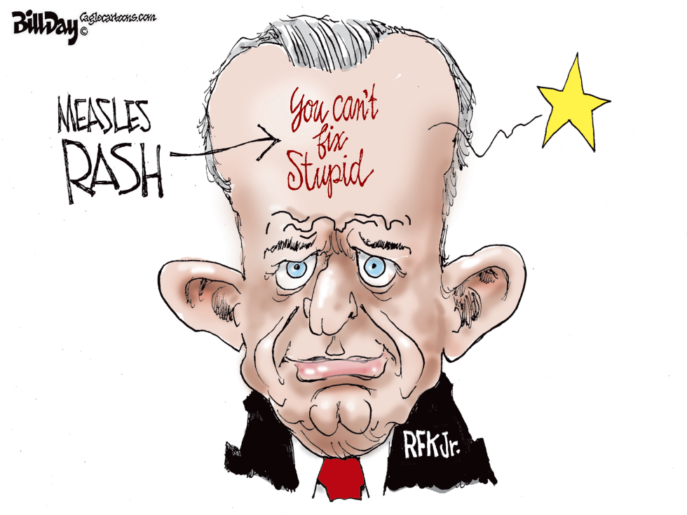 Measles Rash