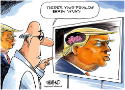 TRUMP HEALTH CONCERNS by Dave Whamond