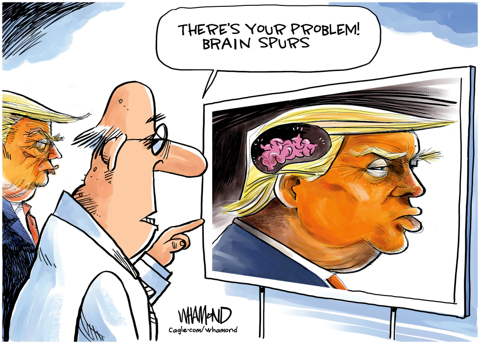 Doctor Points to Brain Spurs on Trump Scan