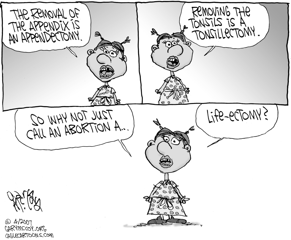 Life-ectomy