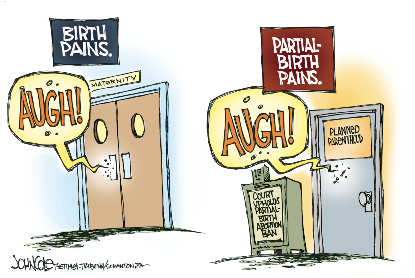 Partial-birth pains