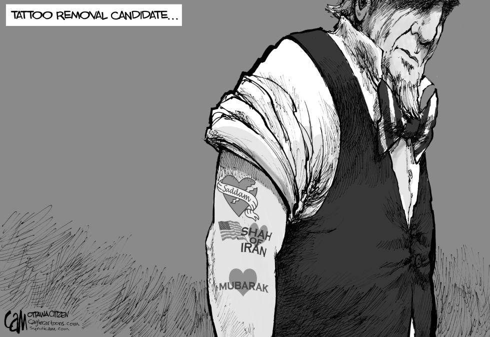 Tattoo Removal